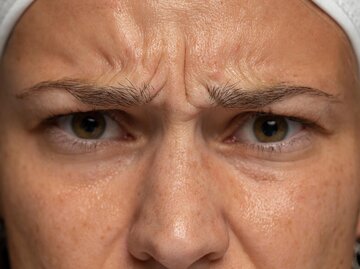 Frau mit Zornesfalten im Gesicht | © AdobeStock/vladimirfloyd