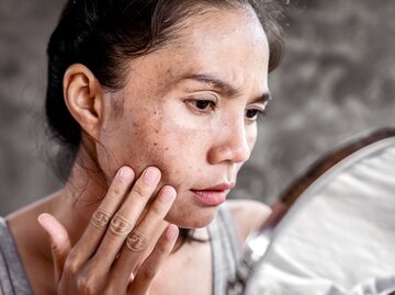 Eine Frau schaut sich im Spiegel an und begutachtet ihre Pigmentflecken im Gesicht | © GettyImages/Doucefleur