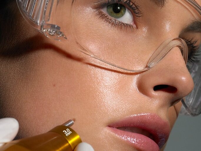 Für die optimale Wirkung von Laser-Treatments sind oft mehrere Besuche notwendig. | © Getty Images | Bill Diodato